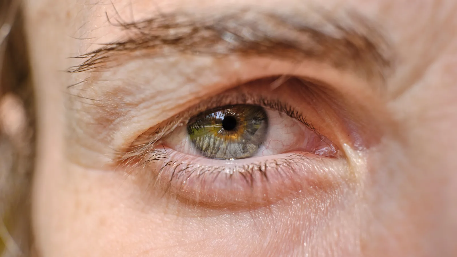 Uso prolongado de tadalafila é associado a maior risco de glaucoma